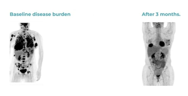 Restora Onco Care Center